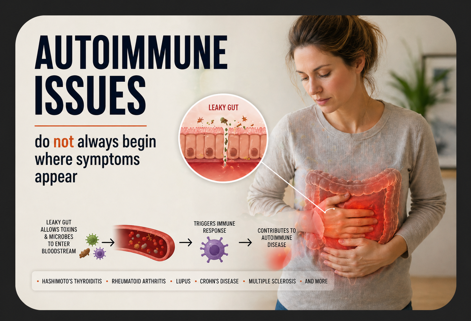 Leaky Gut and Autoimmune Disease